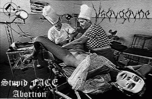 Vsovgovne : Stupid FACE Abortion